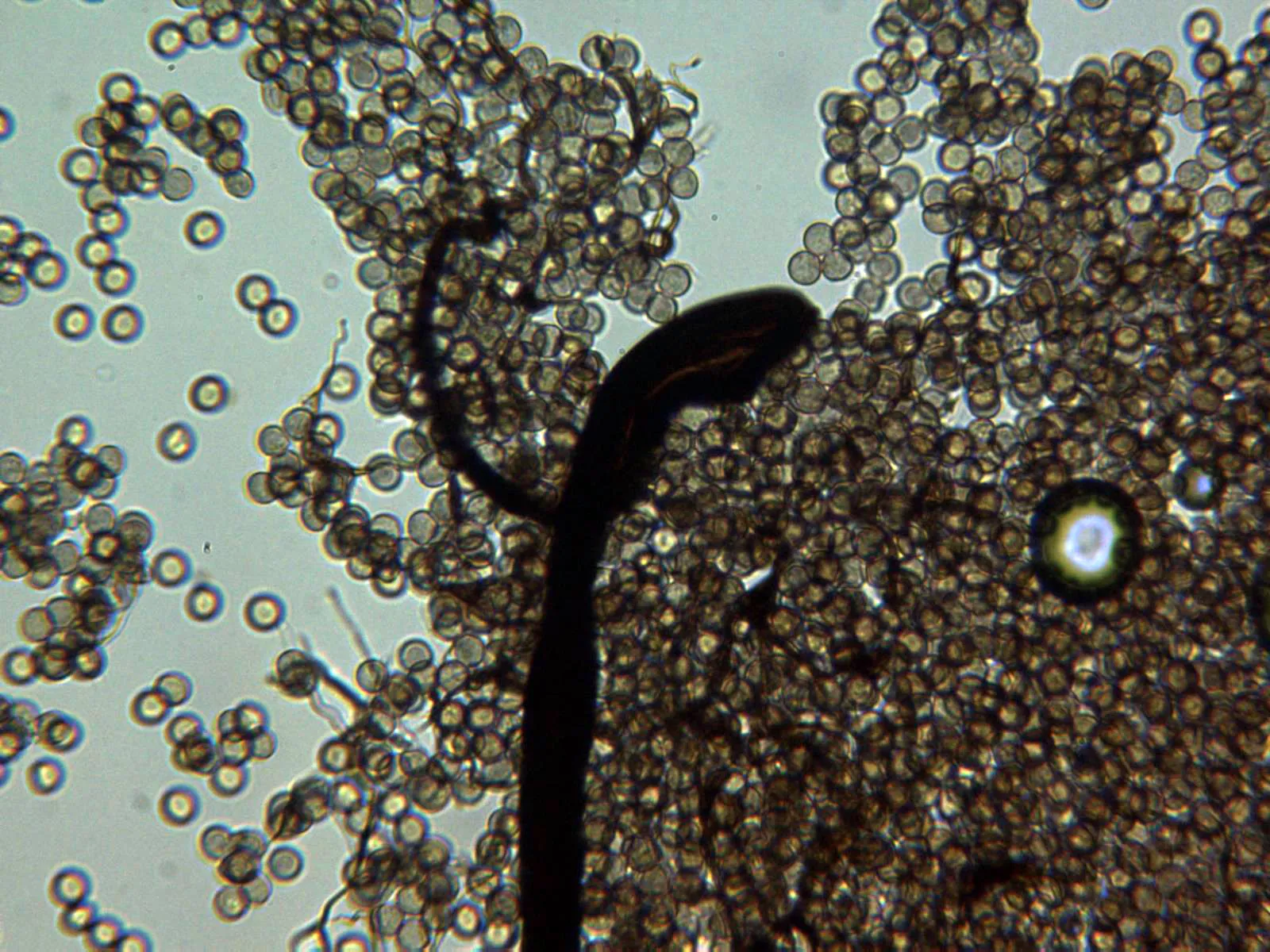 Microscopía de Stemonitis splendens - 10 Columela x 400